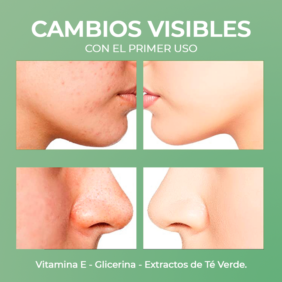 GreenMask® Mascarilla de Té Verde (OFERTA 2X1)