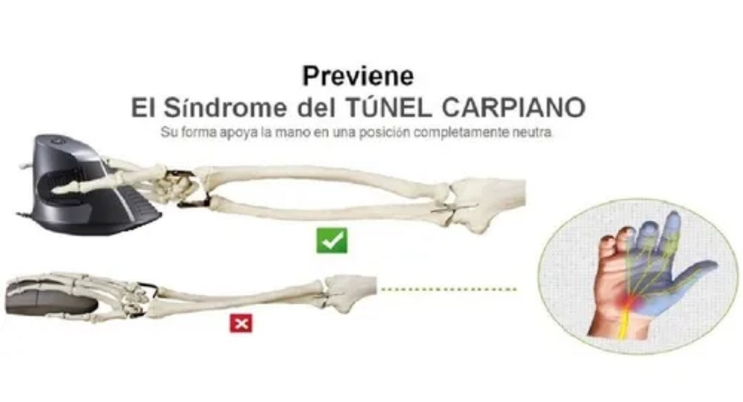 Mouse Vertical Ergonómico