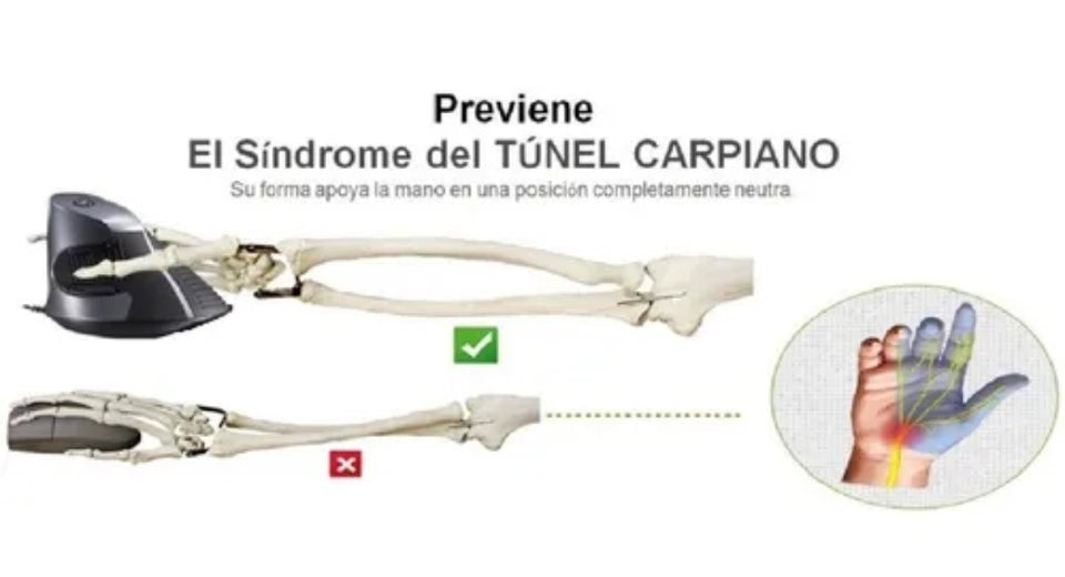 Mouse Vertical Ergonómico